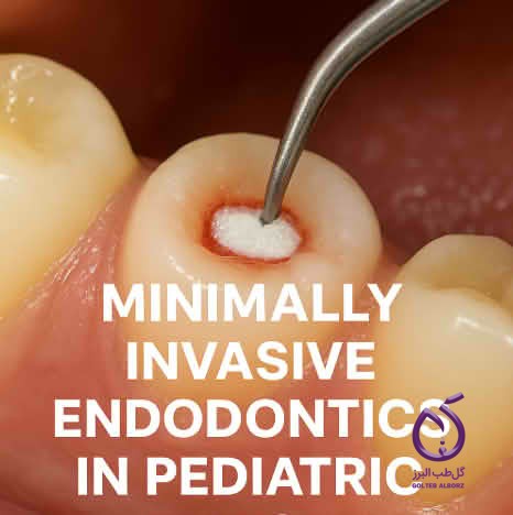 مقایسه دندانپزشکی کم‌تهاجمی (MID) با درمان‌های پالپی: پالپوتومی و پالپ کپینگ