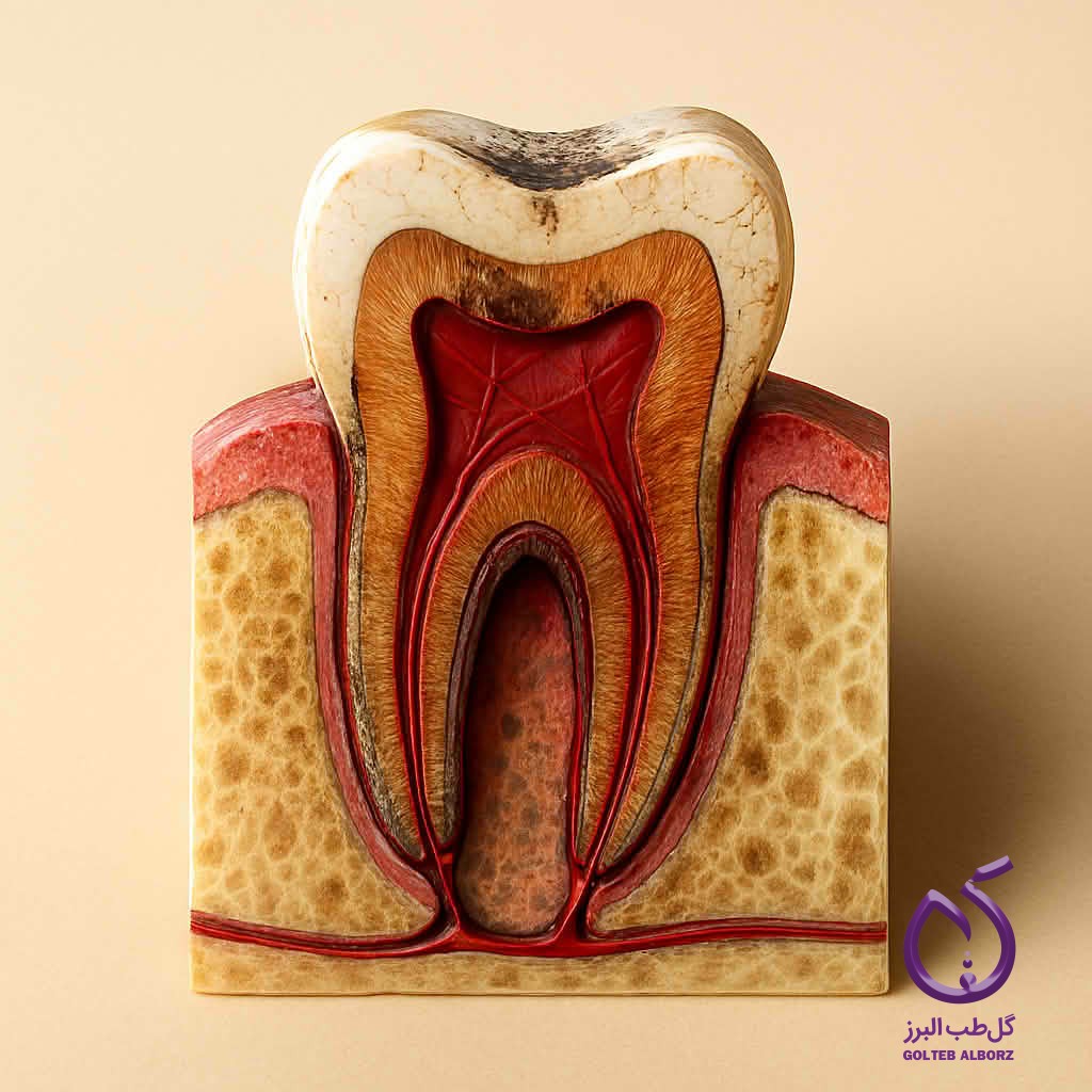 یک دندان ناسالم با ریشه و مینای آسیب دیده