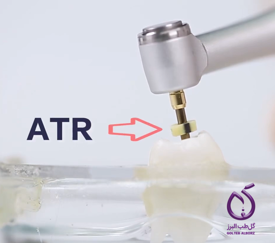 عملکرد معکوس تورک تطبیقی (ATR) در اندوموتورها