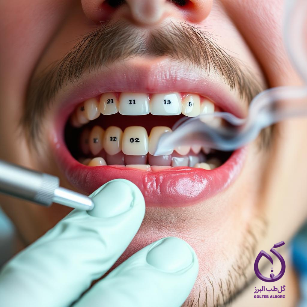 evaluation-of-the-impact-of-smoking-on-orthodontic-treatment