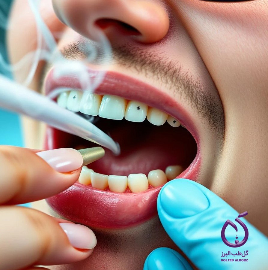 ارزیابی اثرات سیگار کشیدن بر نتایج درمان ارتودنسی