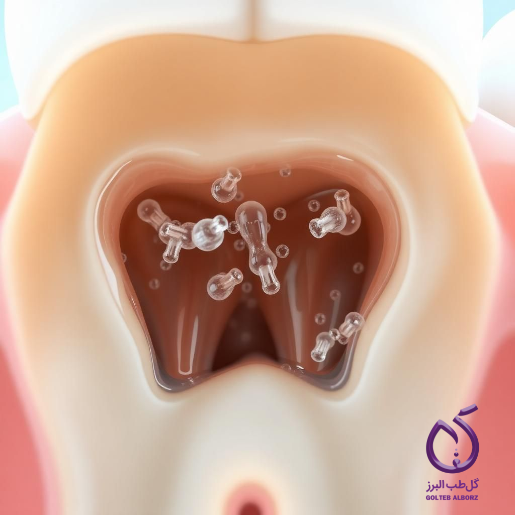 ایریگیشن کانال دندان