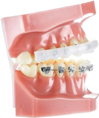 محافظ لب ارتودنسی Lip Protector - IOS